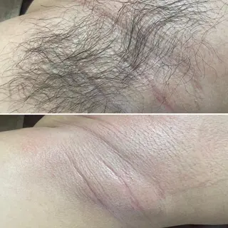 アイブロウ メンズ キッズ Epina 千葉店 【エピナ】のエステ・リラクイメージ