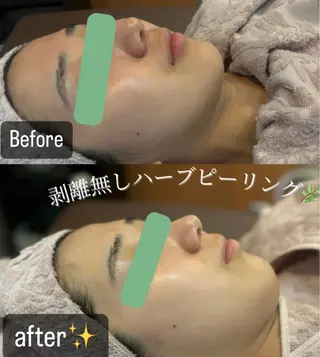 Care Salon COCO 【自由が丘店】所属・看護師施術サロン🍃 夢乃のエステ・リラクイメージ
