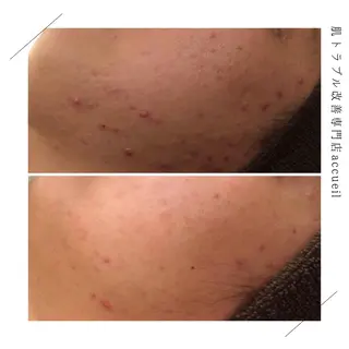 ミディアム カラー パーマ ヘアアレンジ メンズ キッズ ネイル マツエク・マツパ アイブロウ 触れたくなる モテ肌へ...❤︎のエステ・リラクイメージ