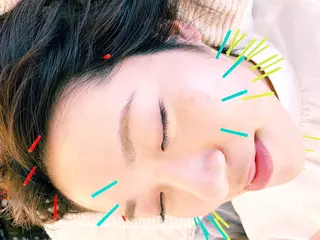 小顔美容鍼専門サロン 渋谷YZのエステ・リラクイメージ