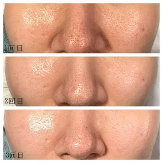 kapua所属・Kapua🌺 マユのマツエク・マツパデザイン