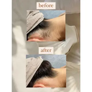 crescent所属・【韓国肌管理・脱毛】 クレセントのエステ・リラクイメージ