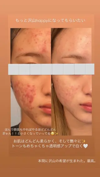 Terra.所属・松村 彩乃のエステ・リラクイメージ