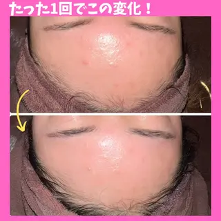 痩身&美肌サロン 堀米✨のその他イメージ