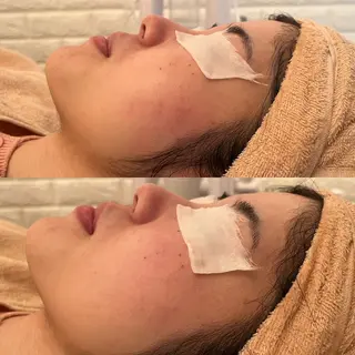 毛穴ケア/毛穴診断/ 毛穴洗浄〔心斎橋〕のエステ・リラクイメージ