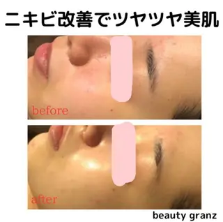 痩身専門サロン ビューティーグランツのエステ・リラクイメージ