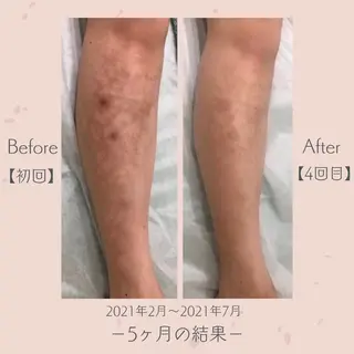 エステ＆美肌脱毛 ココサロ倉敷店のエステ・リラクイメージ