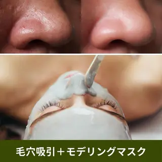 ハーブピーリング肌 管理🌿Ante関内のエステ・リラクイメージ