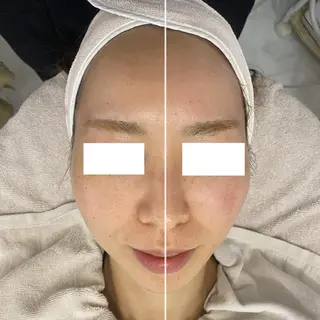 ✨美肌水光✨ アトリエリュバンのエステ・リラクイメージ