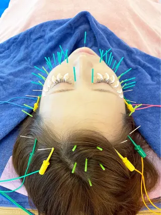 小顔美容鍼専門サロン 渋谷YZのエステ・リラクイメージ