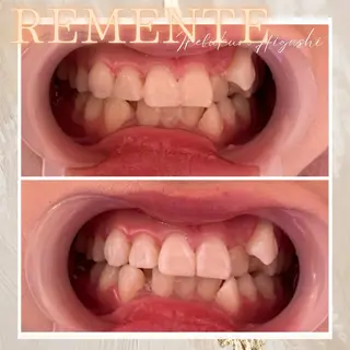REMENTE🌷 Maoの眉毛・アイブロウイメージ