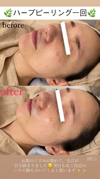 メンズ Salon de Lino 御器所のエステ・リラクイメージ