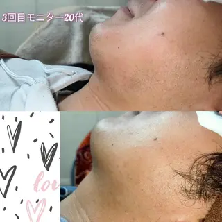 メンズ 武 藤のエステ・リラクイメージ