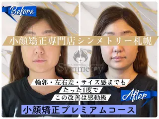 小顔矯正専門店 シンメトリー札幌のエステ・リラクイメージ