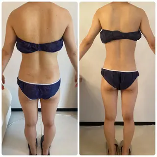 FLEUR大阪・整体 ・ハイフ・痩身・小顔のエステ・リラクイメージ