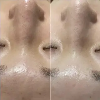 ✨美肌水光✨ アトリエリュバンのエステ・リラクイメージ