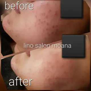 lino salon moana所属・lino salon  moanaのエステ・リラクイメージ