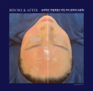 Honey Moom所属・Honey Moomのエステ・リラクイメージ