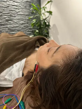 美容鍼灸整体サロンBeauJu所属・小顔矯/美容鍼/鍼灸 BeauJuのその他イメージ