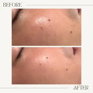 GranDir所属・GranDir 堀井美沙のエステ・リラクイメージ