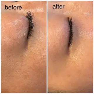 leolo武蔵浦和 肌質改善&脱毛のエステ・リラクイメージ