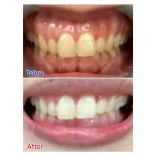 MBEAUTYSALON 千葉店・京成大久保所属・Melty 輝のその他イメージ