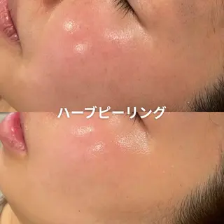 EST BEAUTY所属・顔専門ワックス脱毛/ ハーブピーリングのエステ・リラクイメージ