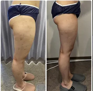 FLEUR大阪・整体 ・ハイフ・痩身・小顔のエステ・リラクイメージ