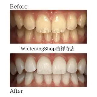 ホワイトニング ショップ吉祥寺店のエステ・リラクイメージ