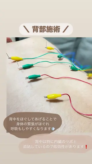 美容鍼/鍼灸 ここみ鍼灸院のエステ・リラクイメージ