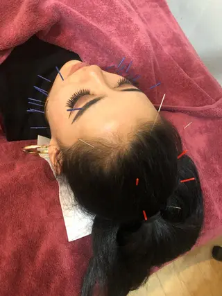 美容鍼灸女性専用 りんご鍼灸治療院のその他イメージ