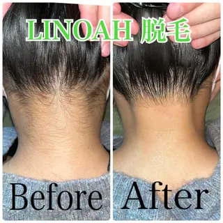 ビューティーサロン リノアのエステ・リラクイメージ