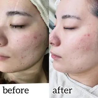 laluna saki...のその他イメージ