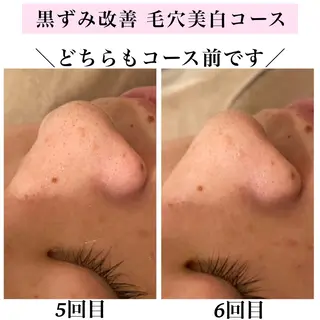 Bellesthe (ベルエステ)のエステ・リラクイメージ