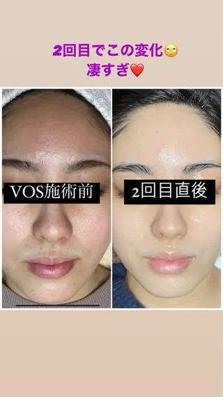 代表 MOMOの眉毛・アイブロウイメージ