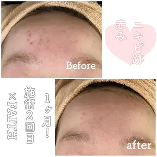 ショート カラー パーマ ヘアアレンジ メンズ キッズ ネイル マツエク・マツパ ニキビ&跡改善サロン オーナー光木のエステ・リラクイメージ