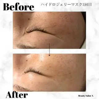 体質／肌質改善専門店 Y.【ワイドット】のエステ・リラクイメージ