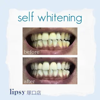 noel de mi 前川亜里沙のエステ・リラクイメージ