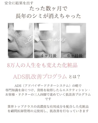 private salon  Dea_maris シュガーリング＆パーソナルボディケア所属・シミ改善・韓国肌管理 ボディメイク痩身のその他イメージ
