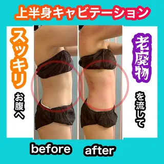 痩身/脱毛/ネイル HARUKAのエステ・リラクイメージ