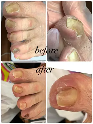 ネイル メンズトータルビューティーwellnessMARCA所属・【メンズ美容】 三浦かえでのエステ・リラクイメージ