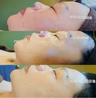 鍼灸サロン　MARINOTE所属・鍼灸サロン MARINOTEのエステ・リラクイメージ