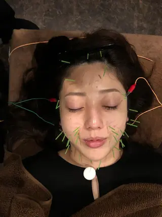 美容鍼灸サロン LOMIHARIのエステ・リラクイメージ