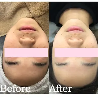 BestBelleꕤ 大阪福島/肌質改善のエステ・リラクイメージ