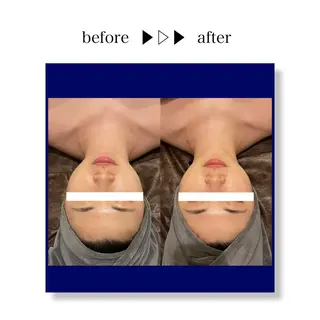 ☆痩身/小顔☆ 結果出します☆のエステ・リラクイメージ