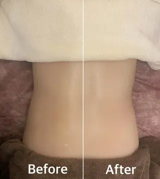 ✨美肌水光✨ アトリエリュバンのエステ・リラクイメージ