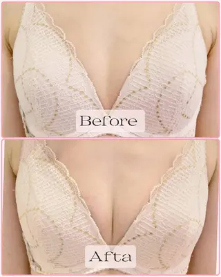 マシュマロバスト coucouのエステ・リラクイメージ