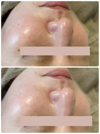 Beauty salon Wish所属・脱毛🌈肌質改善🌈 Wishのエステ・リラクイメージ