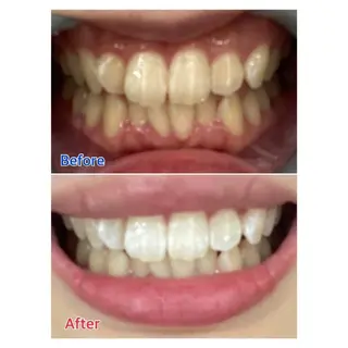 MBEAUTYSALON 千葉店・京成大久保所属・Melty 輝のその他イメージ