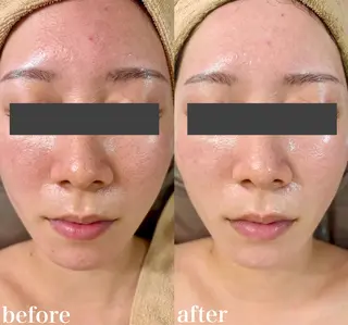 WHITE AQUA 北千住店のエステ・リラクイメージ